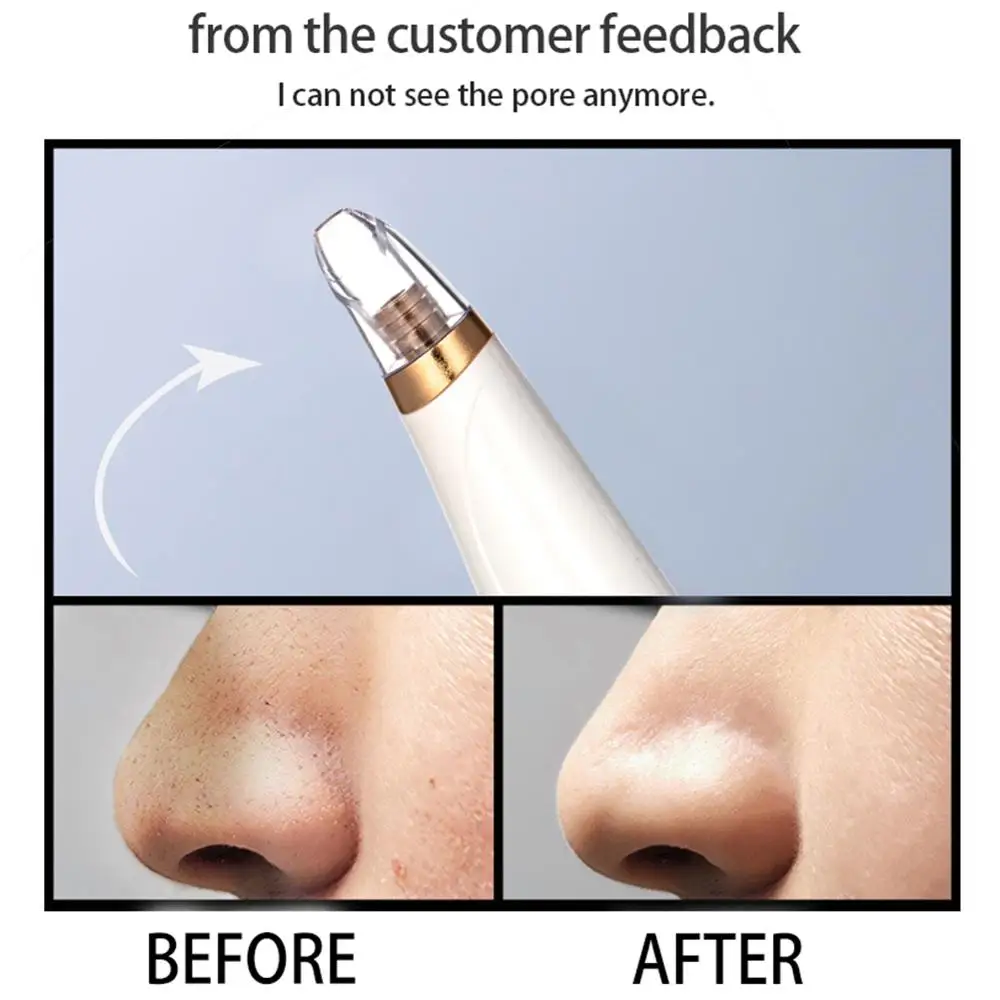 

Blackhead Remover Skin Care Electric Suction Blackhead Remover Pore Cleanser Blackhead Beauty Device Vacuum Pore Cleaner