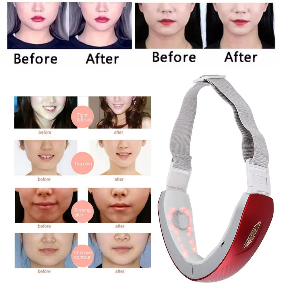 

V Face Machine Electric EMS Vibration Photon Light Therapy Face Lifting Firming Massager To Remove Masseter Muscle Double Chin