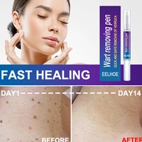 flat warts skin repair warts mole pen no trace beauty liquid skin treatment papilloma of removal skin label herbal cream 1pcs