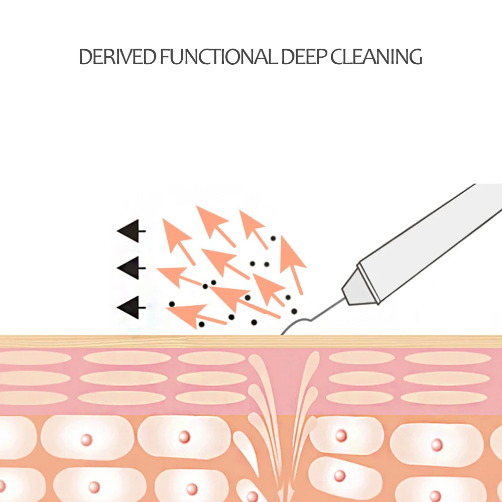 Ультразвуковой аппарат для удаления угрей на лице пилинг-эксфолиент подтяжка