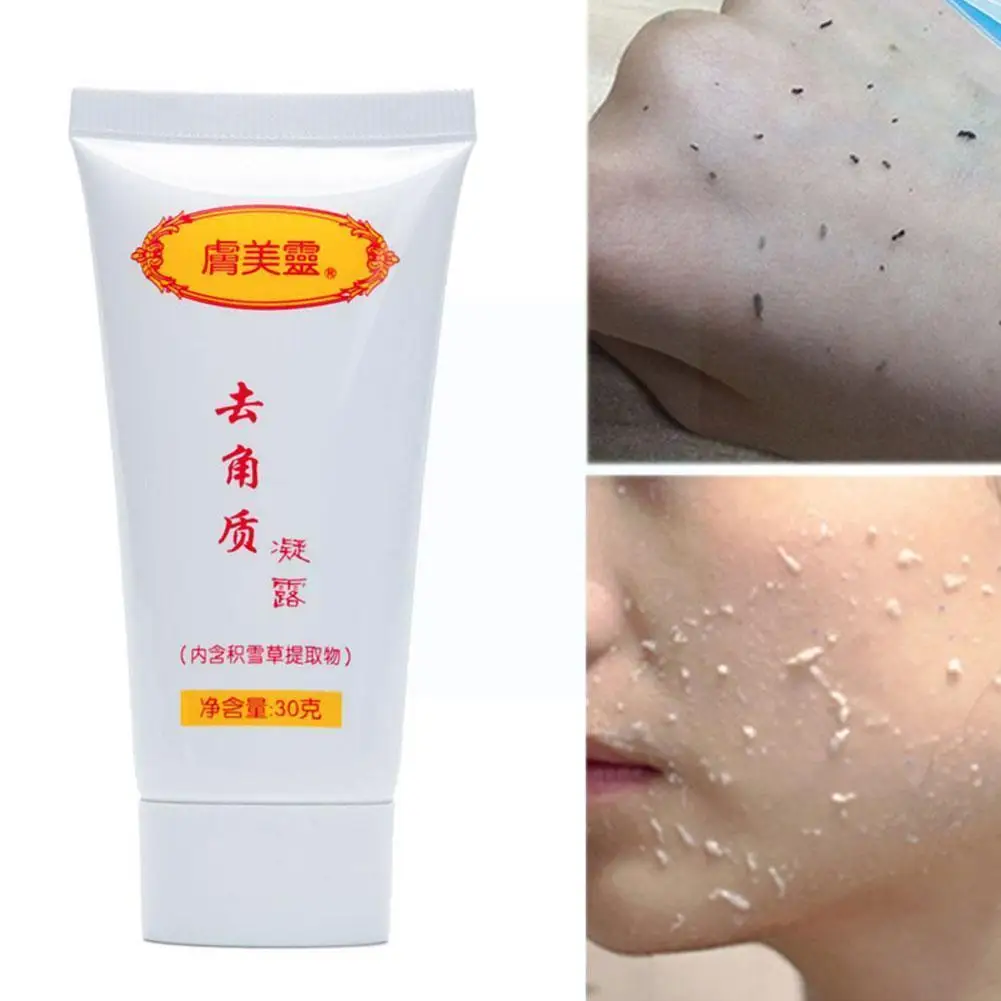 

30g Ginger Exfoliating Hyaluronic Acid Nourishing Moisturizing Gel Lotion I9h4