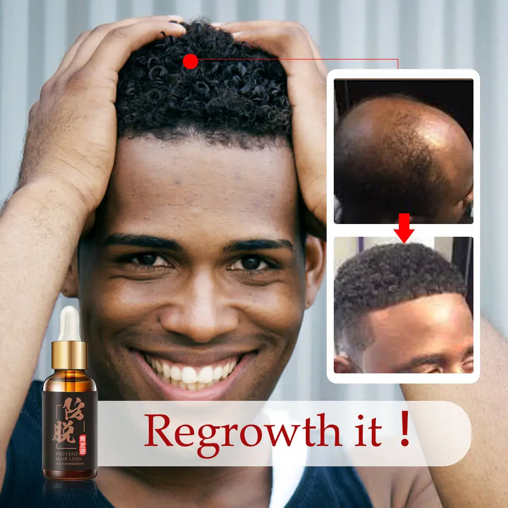 Масло для роста волос и ускоренный рост уход за продуктами выпадения натуральные