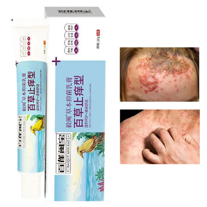 

1Pcs Baicao Antipruritic Cream Antibacterial Psoriasis Eczema Mosquito Bites Seborrheic Dermatitis Repair Body Skin Care 20g
