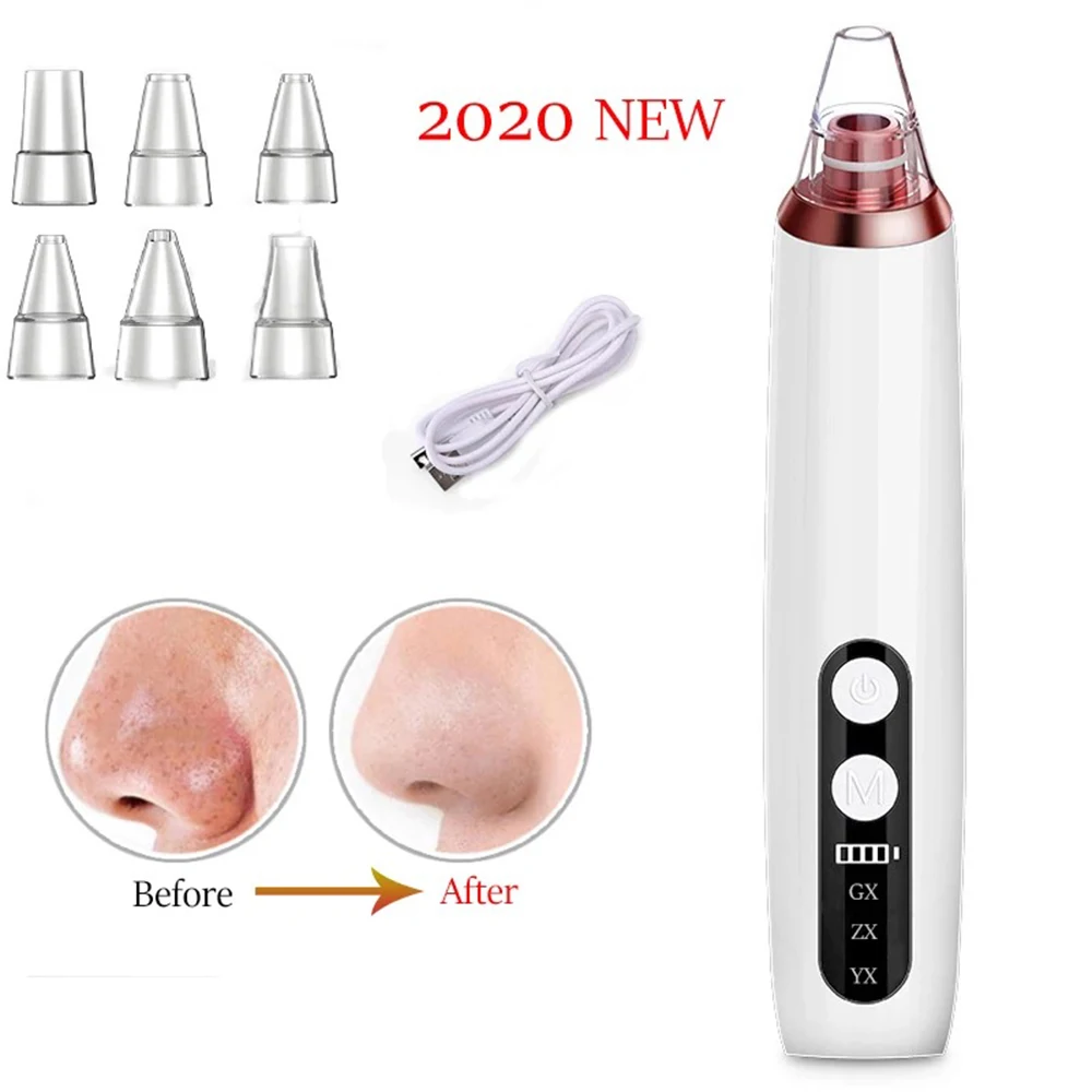 Инструмент для удаления угрей Электрический вакуумный удалитель носа лица