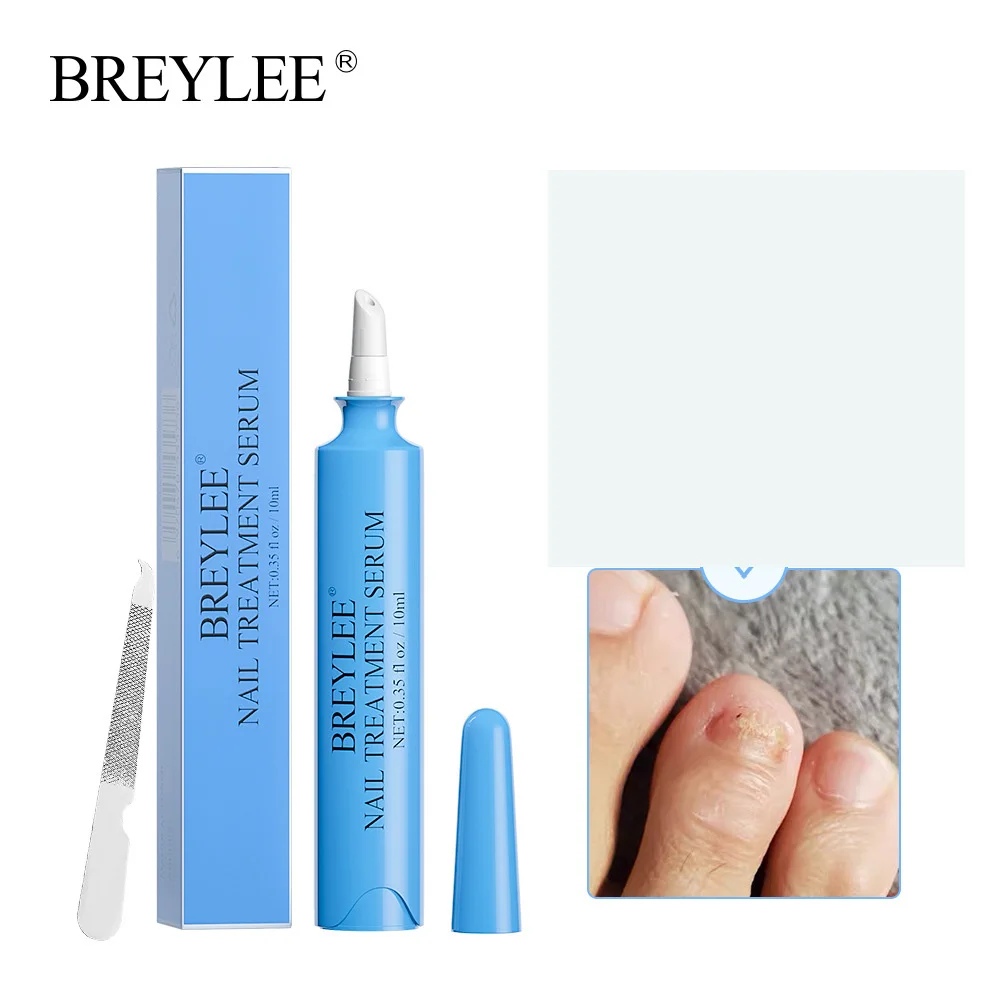 

BREYLEE Сыворотка для лечения Ногтей, гель-ручка для ремонта ногтей 10 мл, Лечение грибка ногтей, масляная ручка для кутикулы, гель для ногтей, ин...