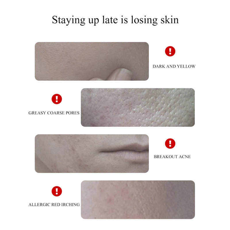 Маска для ухода за кожей лица Centella растительная Отбеливающая увлажняющая маска