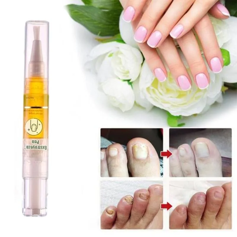 

Anti Fungal Repair Nail Treatment Pen Onychomycosis Anti Nails Fingernails Effective Fungal Fungus Finger Gel Toe Nail Y9S9
