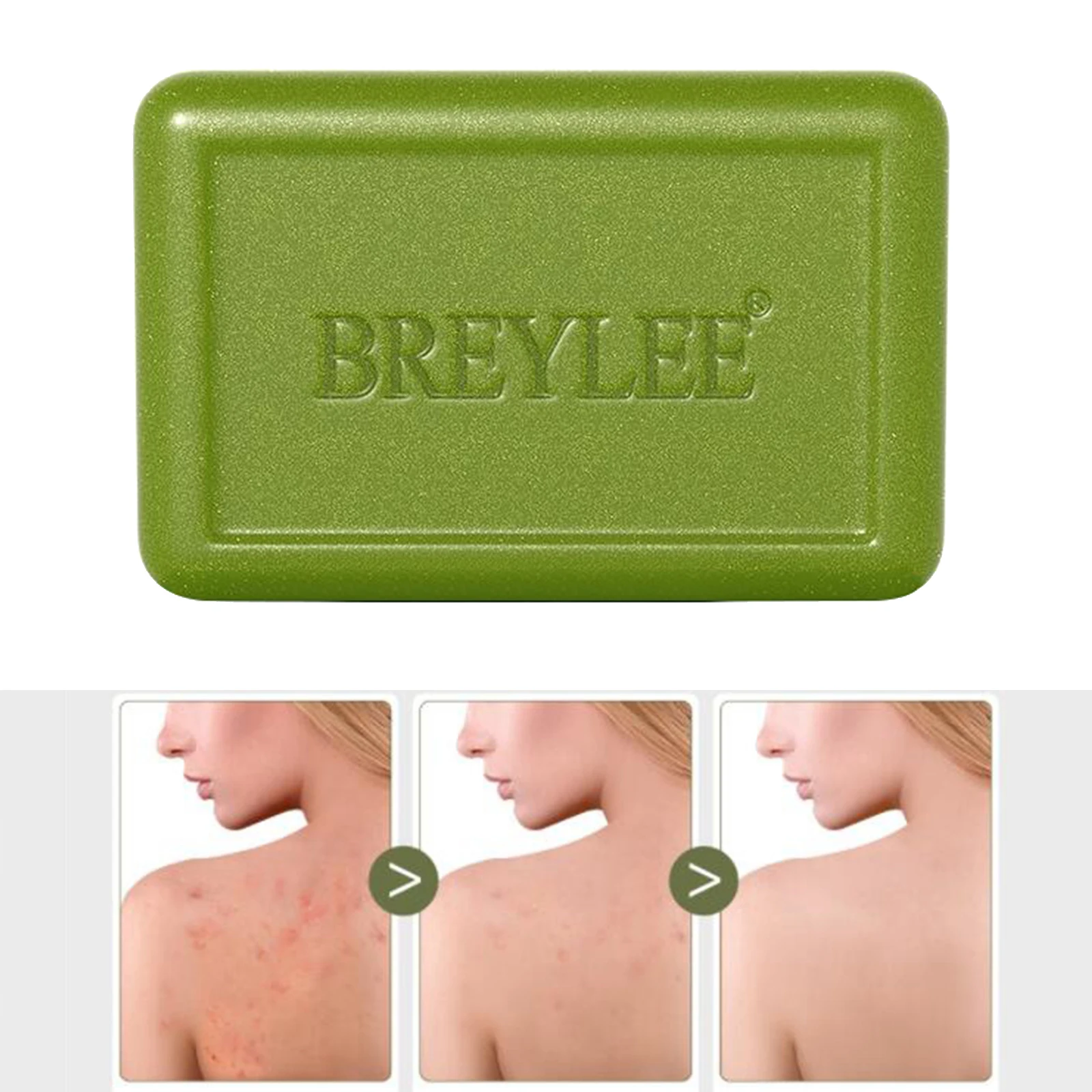 BREYLEE 80 г кускового мыла обработки удаления Управление мыло глубокое