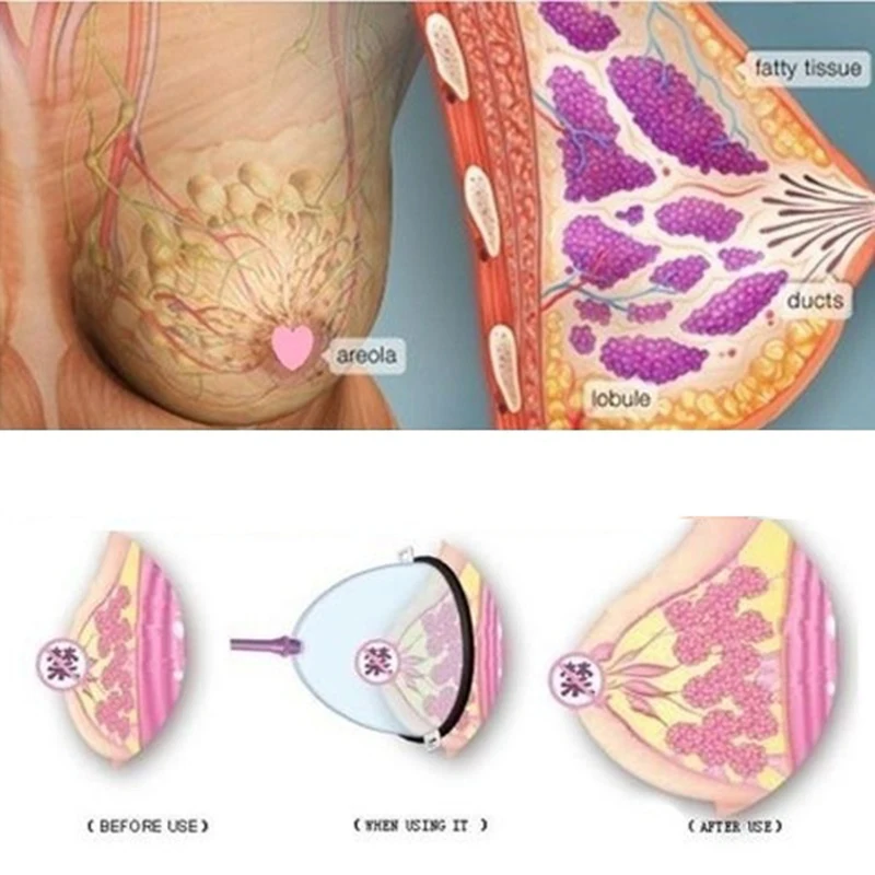 

Massage Body Cups Rubber Vacuum Cupping Glasses Cupping Anti Cellulite Cupping Massage Vacuum Therapy Massage Tool