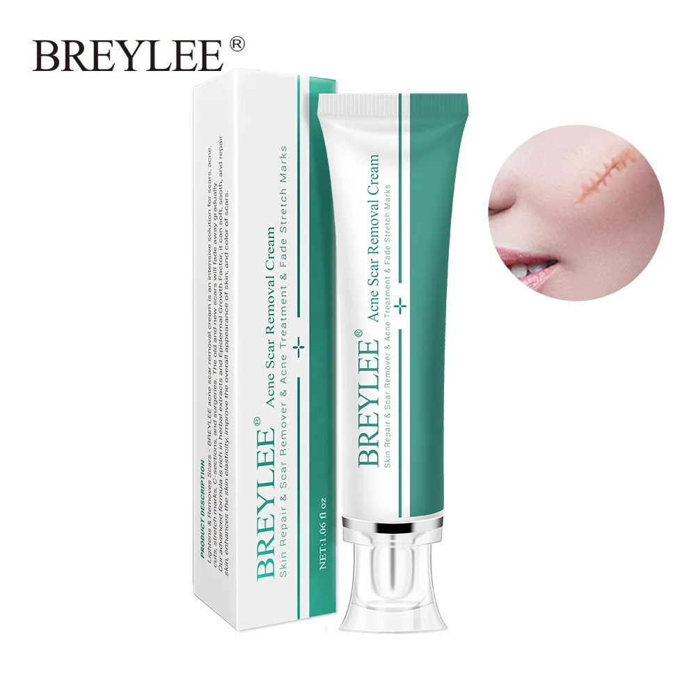 

BREYLEE Acne Scar Removal Cream Pimples Stretch Marks Spots Remove Treatment Smoothing Whitening Body Skin Repair Gel 30g