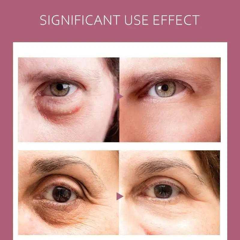 

30g Eye Cream Moisturizing Nourish Remove Wrinkles Protect Lift Care Hydrate Skin Anti-Aging Tighten Cream Rose Brighten Re L8S9