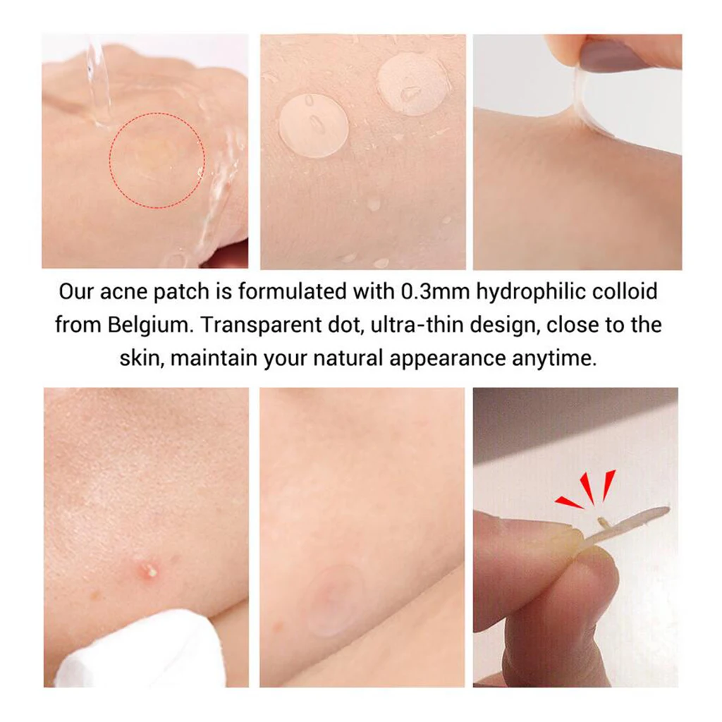 25/28pcs Hydrocolloid Acne Remover Pimple Patch Stickers Tag Transparent Acne Pimple Patch Acne Treatment Stickers Remover Tool