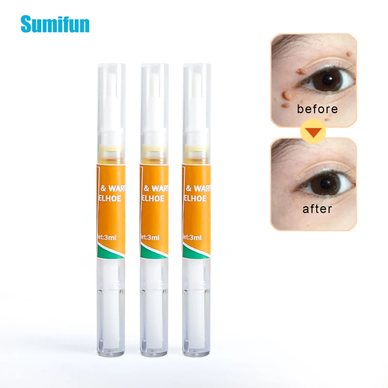 

1/3pcs Skin Tag Remover Against Mole & Genital Wart fast Remover Anti Foot Corn Removal Warts Papillomas Rapidly removes mole