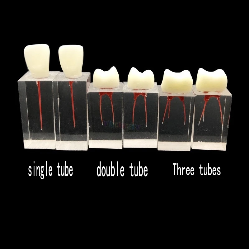 1 шт./3 шт. эндодонтическая корневого канала Endo учебный блок с коронами обучения