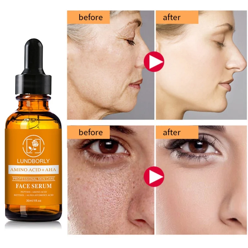 Горячая Распродажа витамин C отбеливание Сыворотки крем для лица с гиалуроновой