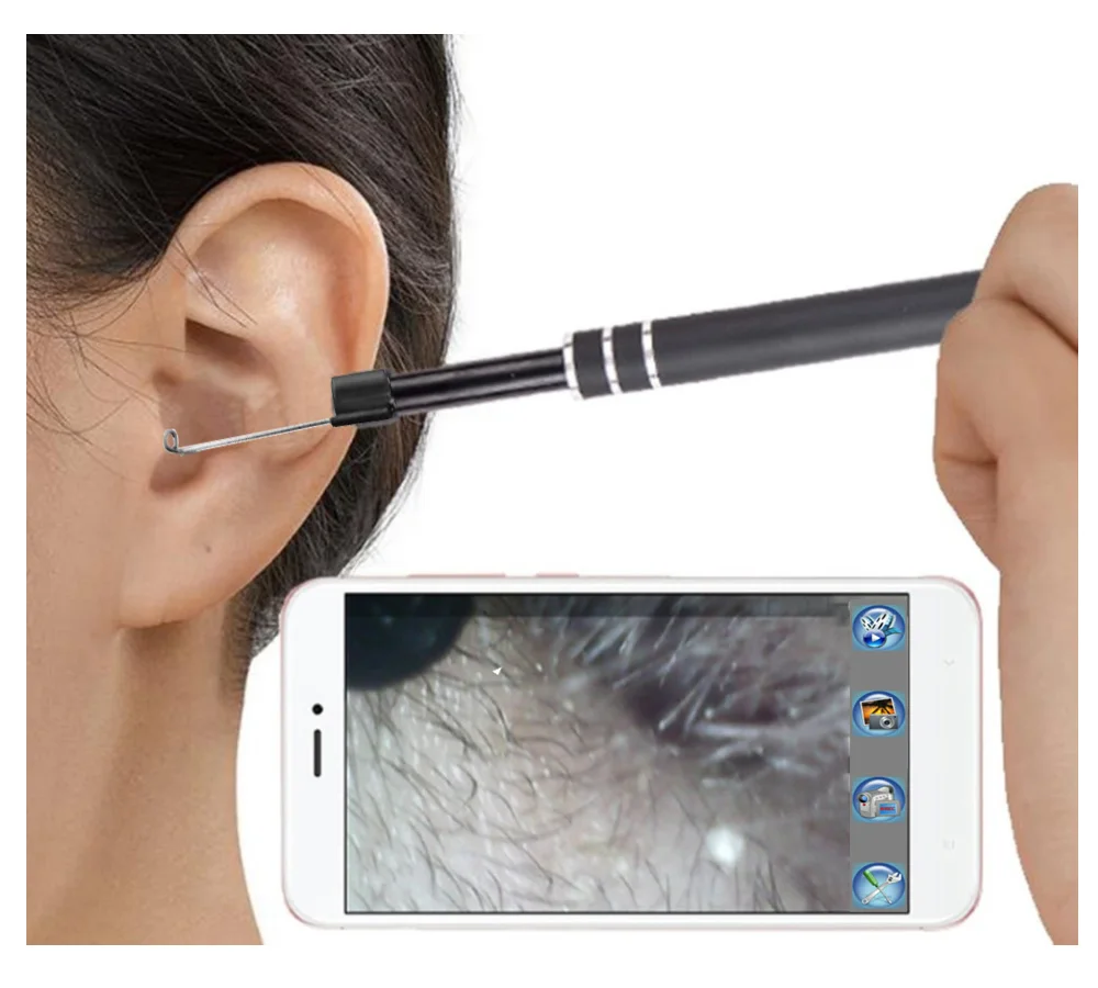 USB инструмент для очистки ушей HD визуальная Ушная ложка многофункциональная