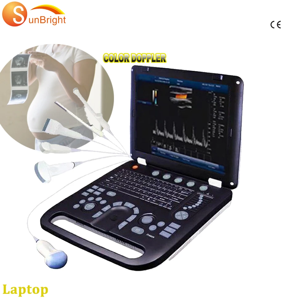 

Equal Sonoscape s2 ultrasound machine price 3D 4D ecografo color Doppler ultrasonido
