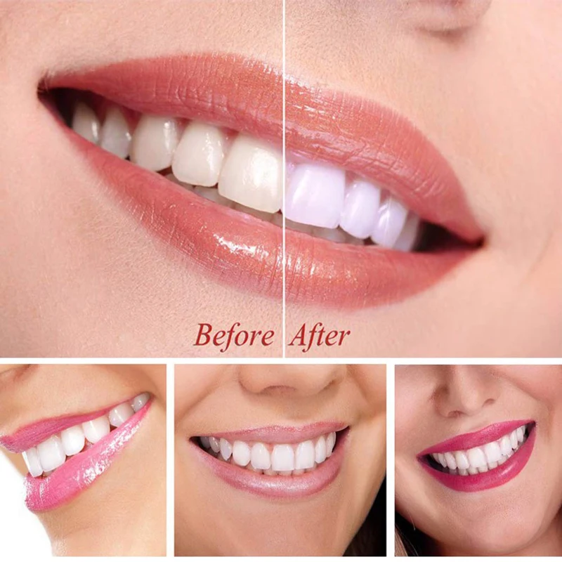 

PUTIMI Whitening Teeth Serum Cleaning Teeth Whitener Dental Tools Remove Plaque Stains Bleaching with Toothbrush Oral Hygiene