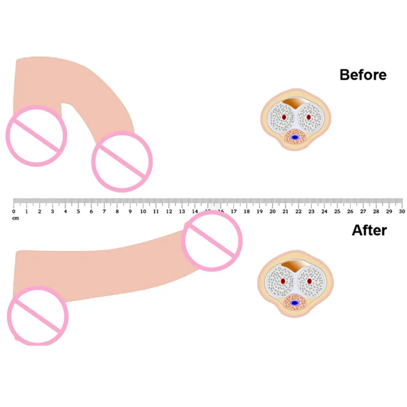 Удлинитель пениса Увеличитель мужской t секс-игрушки для мужчин увеличитель