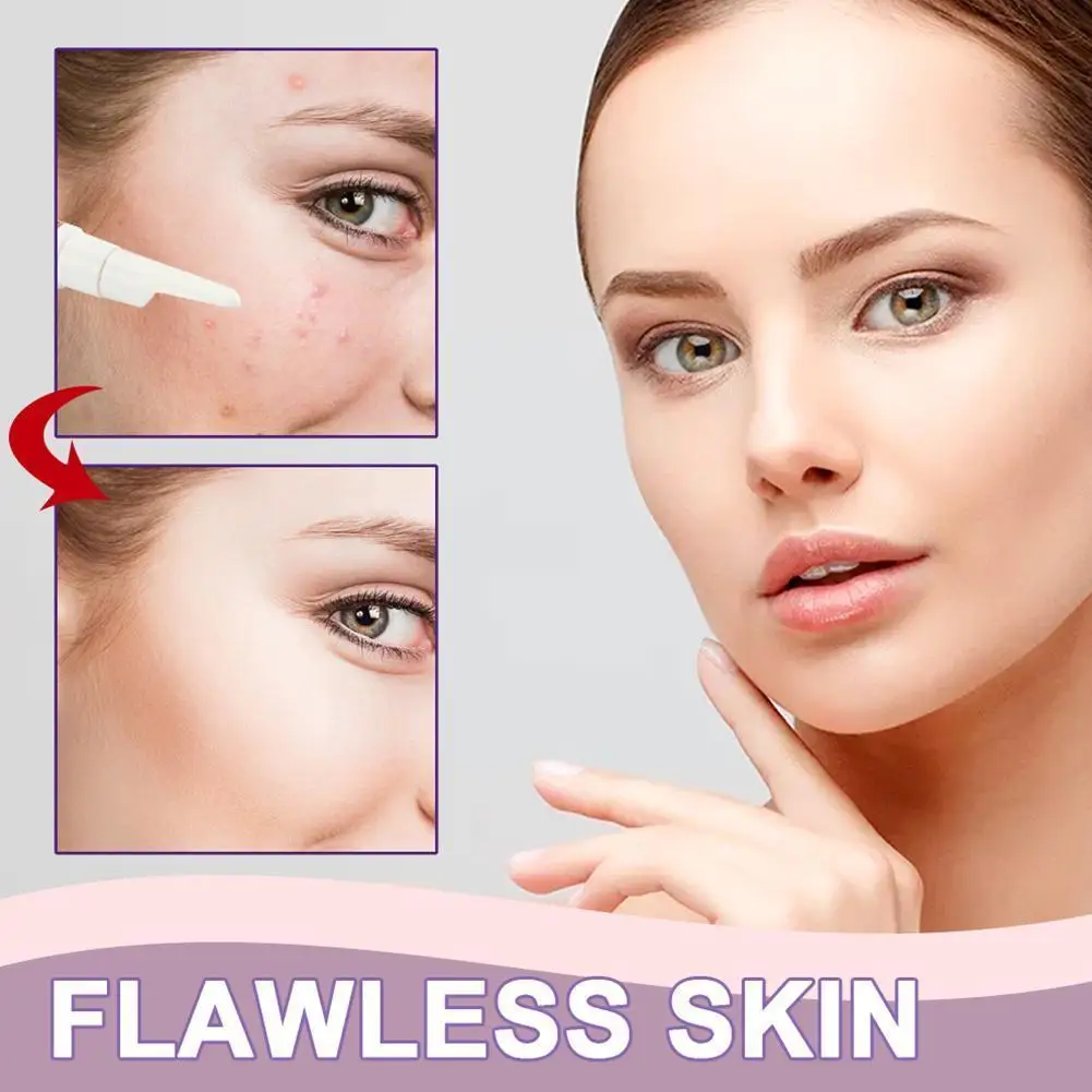 

15ml Vitamin C Freckle Removal Cream Pen Freckle Pigmented Spots Melanin Cream Pencil Remover Effective Whitening Anti-Frec C0J4