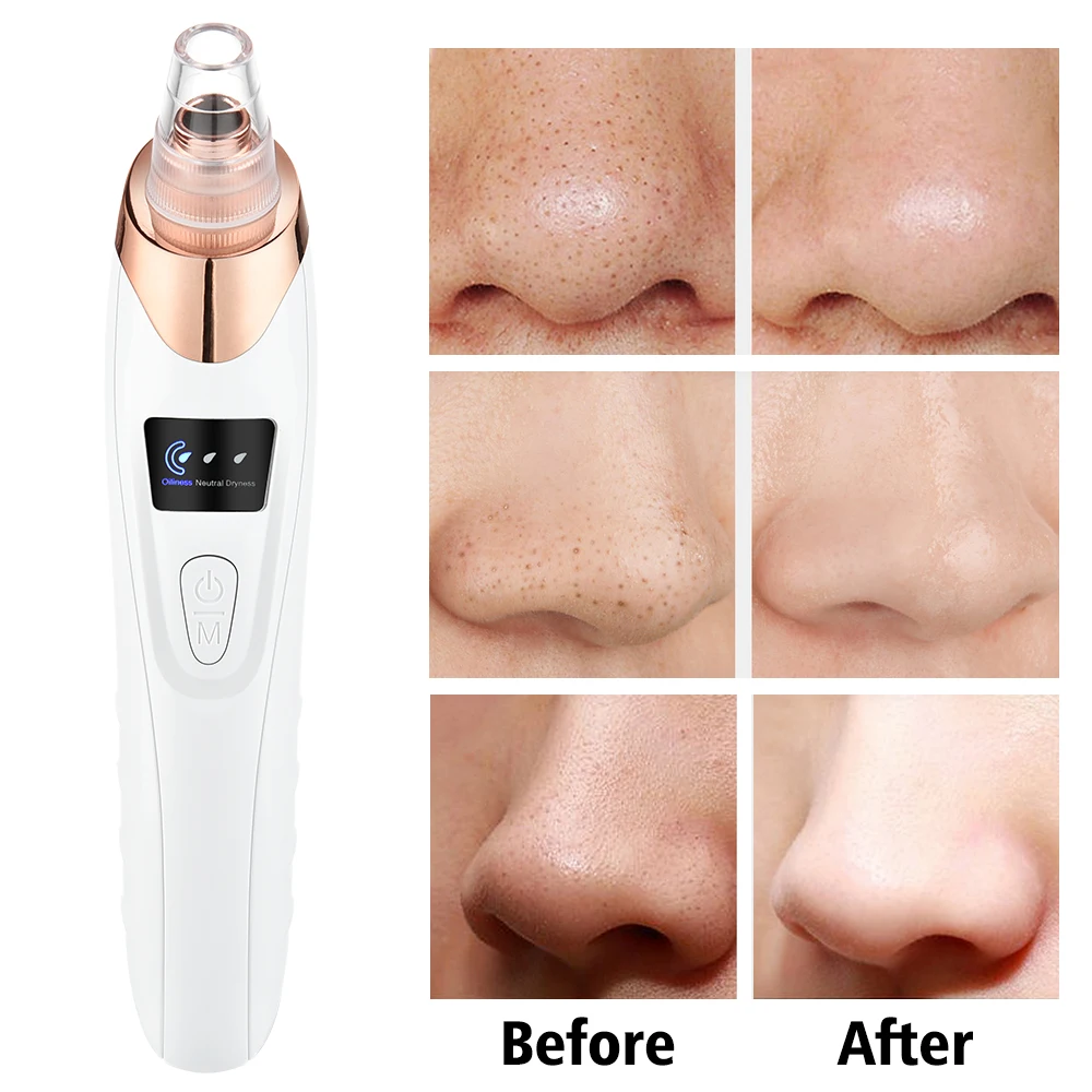 Electric Blackhead Remover Vacuum Pore Cleaner Nose Face Deep Cleansing Skin Care Machine Birthday Gift Dropshipping Beauty Tool | Красота и