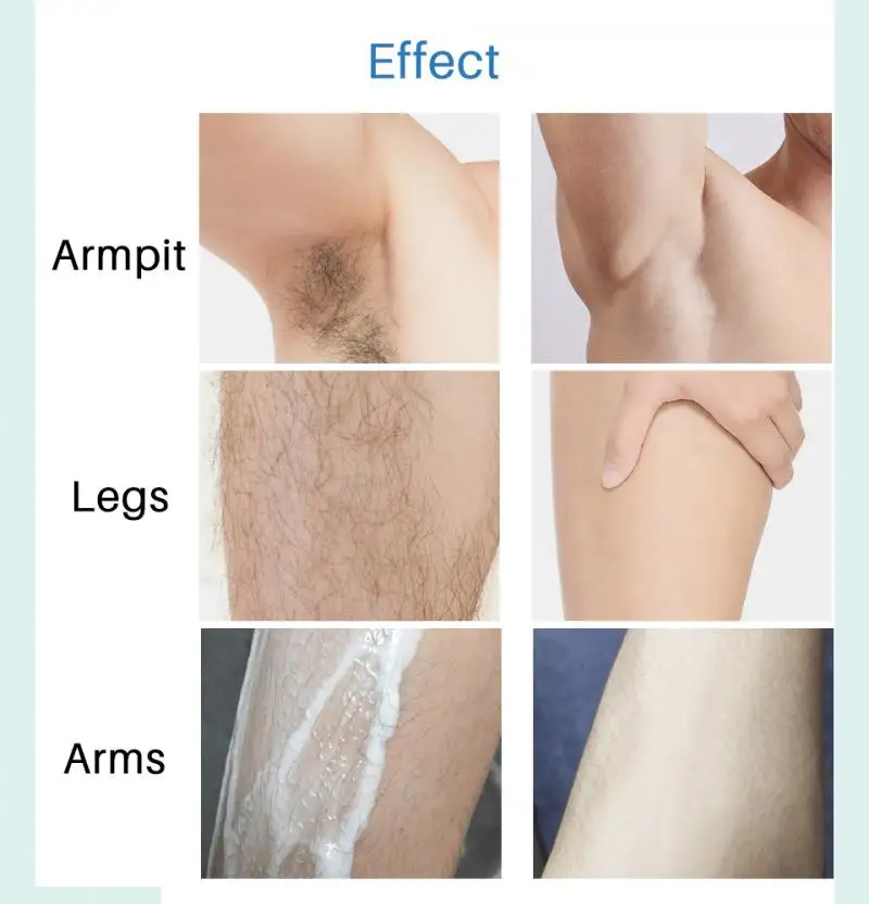 

100% Natural Permanent Hair Removal Spray&Hair Growth Private Parts Hair Remove Hair Removal Cream Natural Aloe Ingredients