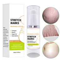 30ml stretch mark control postpartum obesity pregnancy skin care creams remove pregnancy scars moisturizing massage body creams