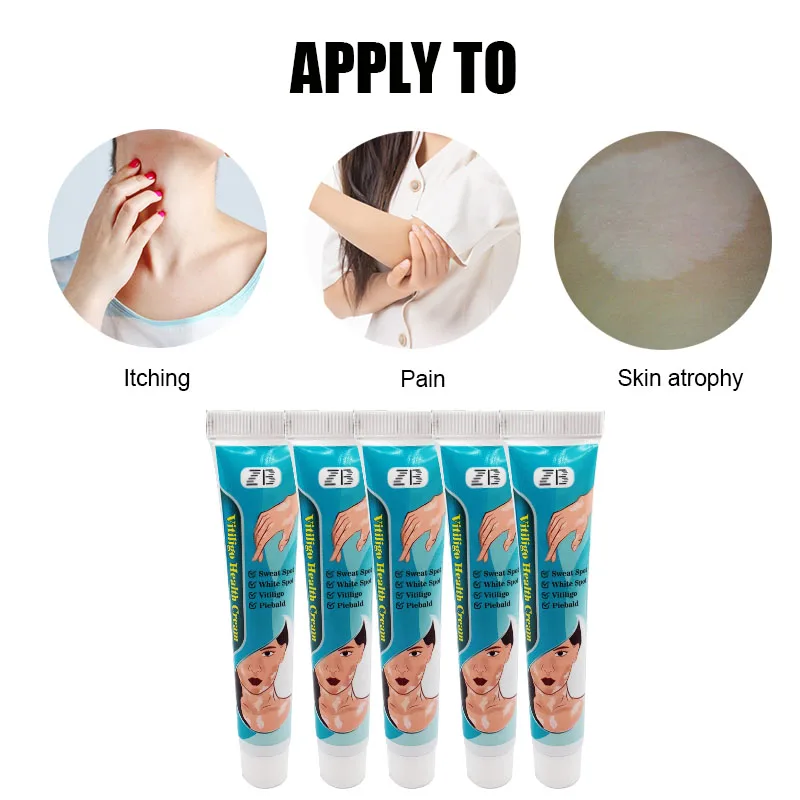 ZB Vitiligo Treatment Cream Sweat Spot Piebald Remove Herbal Medicine Plaster Versicolor Pityriasis Eczma Cure Skin Care Balm | Красота и