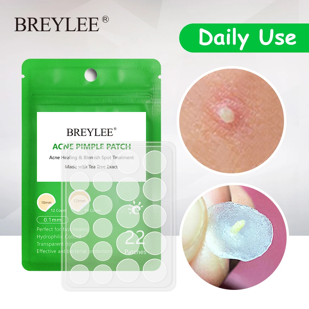 

BREYLEE 22pcs Acne Pimple Patch Day Night Use Sticker Skin Care Acne Treatment Stickers Serum Face Acne Cream Essence Sheet Care