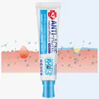 Традиционная китайская медицина, лечение акне, сужение пор, пятен, Женский увлажняющий крем для лица