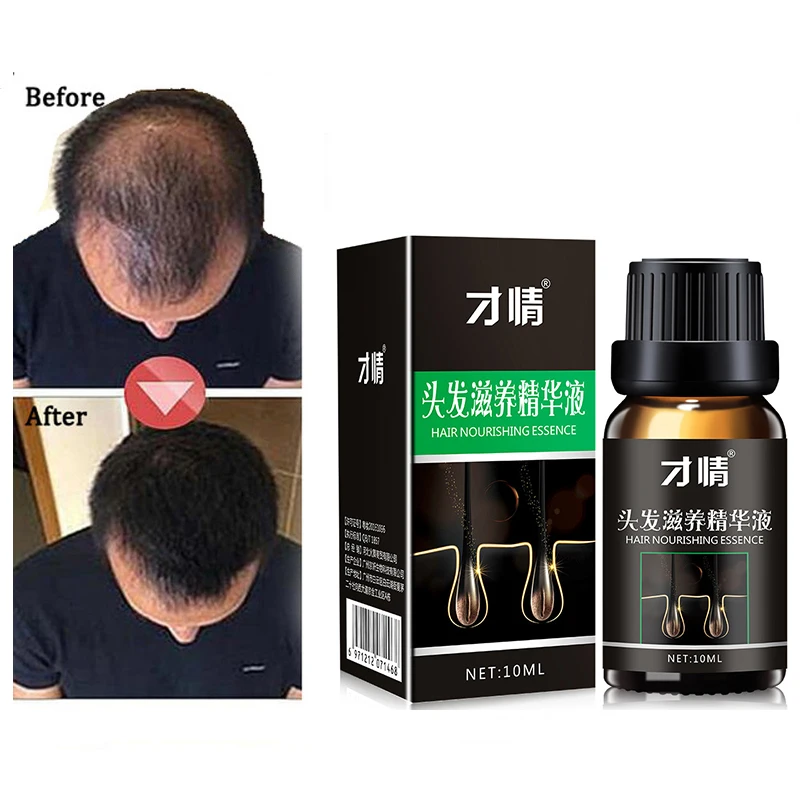 

Hair Growth Products Natural With No Side Effects Faster Grow Hair Treatment Restore Regrowth Pilatory Anti Hair Loss Products