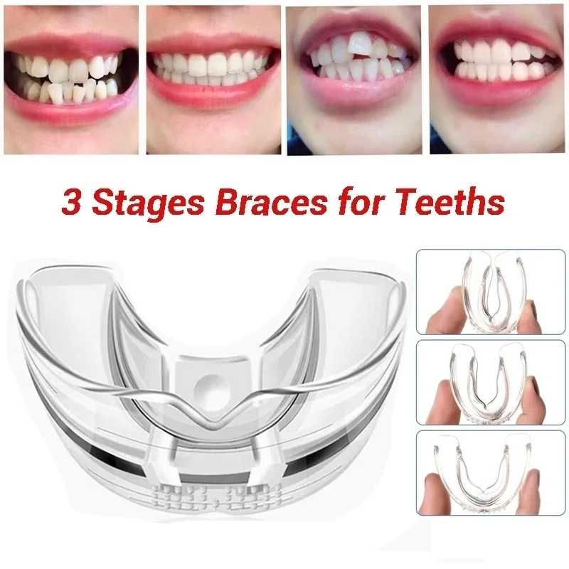 

3 Stages Dental Orthodontic Braces Appliance Braces Alignment Trainer Teeth Retainer Bruxism Mouth Guard Teeth Straightener