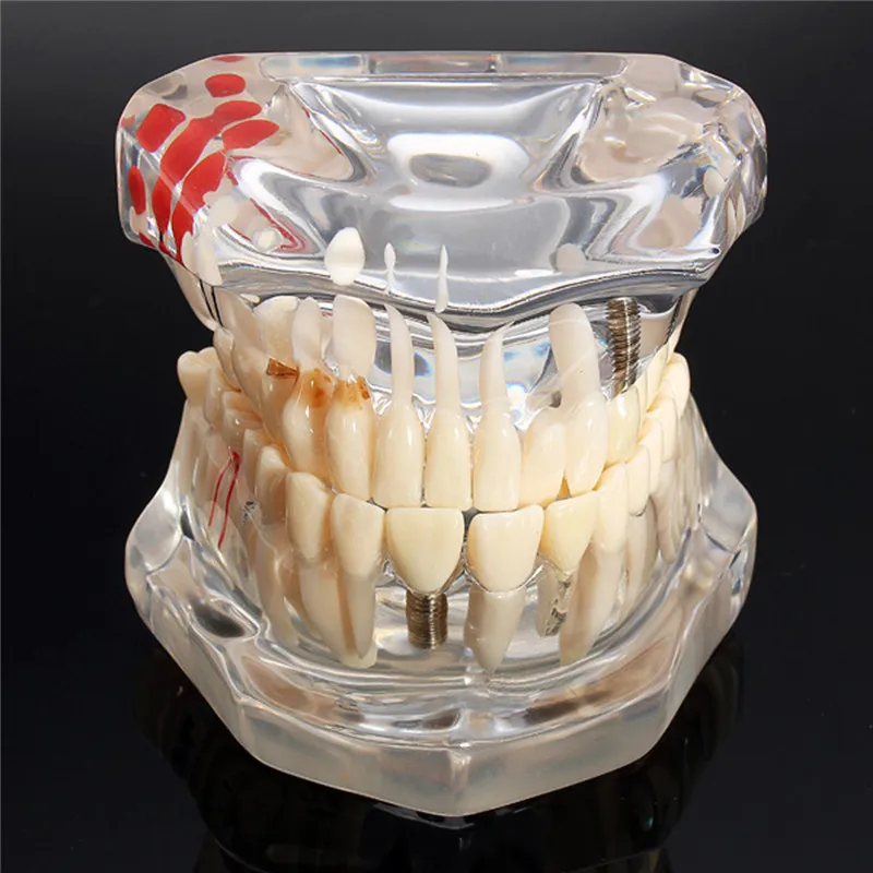 Стоматологические модели для практики зубная щетка hozma купить