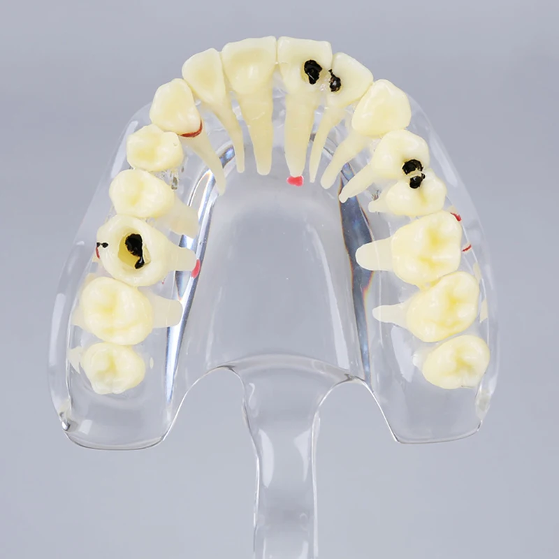 Стоматологическая прозрачная взрослая патологическая Модель дисплея зубов