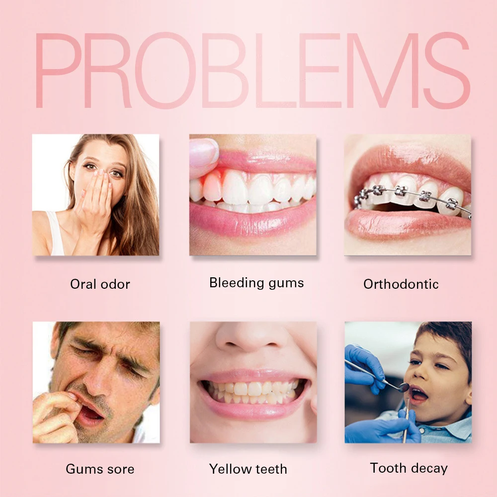 

X7 YUKUI portable dental water flosser electric oral Irrigator usb rechargeable water flosser 220ML Waterproof Teeth Cleaner