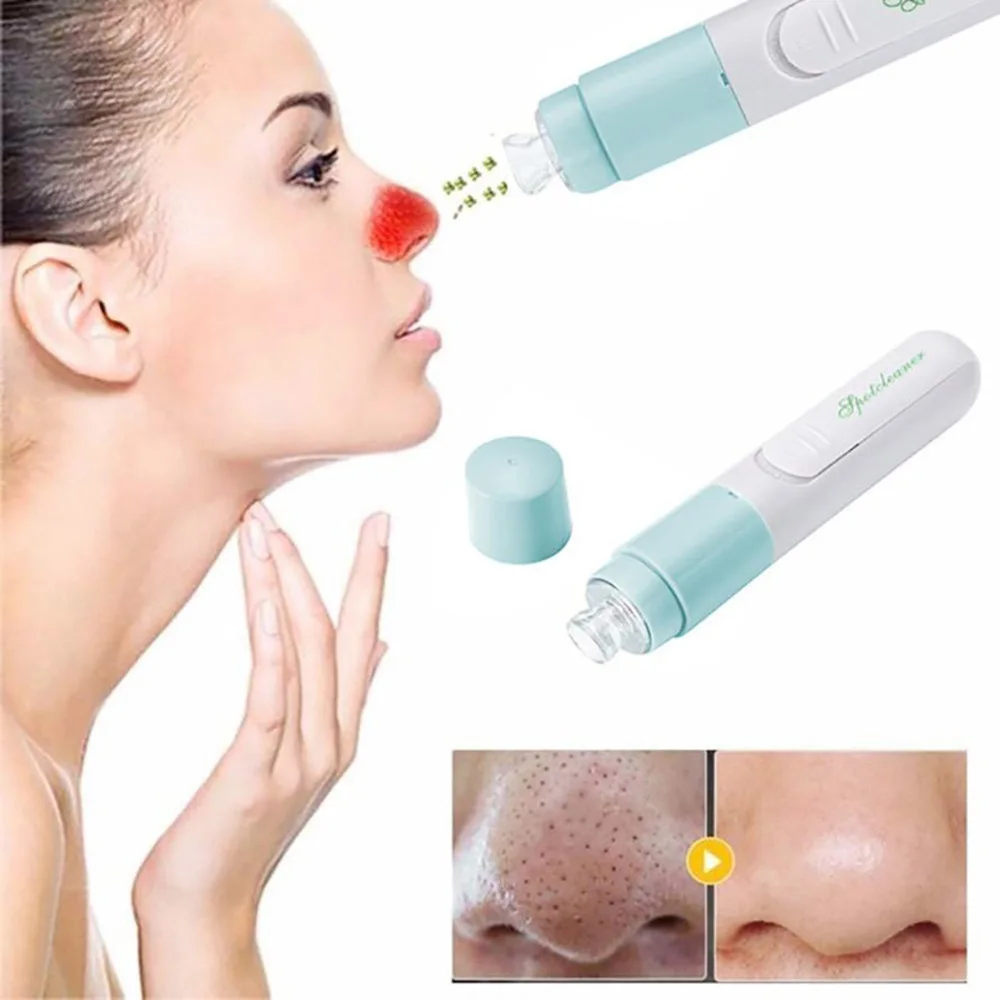 

1pc Blackhead Remover Beauty Tool Green Mini Pore Acne Cleaner Blackhead Remove Exfoliating Vacuum Suction Facial Cleansing Tool