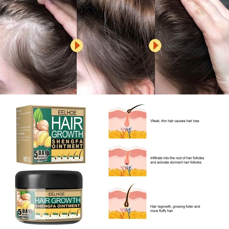 

Ginger Hair Care, Anti-dandruff, Anti-itch, Moisturizing Scalp Massage Cream, Stimulate Hair Follicles, Hair Care Cream