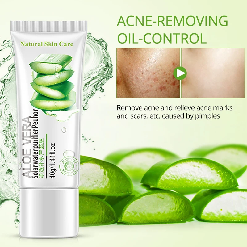 Гладкий гель ROREC с натуральным алоэ вера отбеливание лечение акне увлажнение