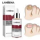 Эссенция LANBENA для лечения ногтей от грибков, сыворотка для восстановления ногтей, удаления грибка, противоинфекции, паронихия, онихомикоз, уход за руками и ногами