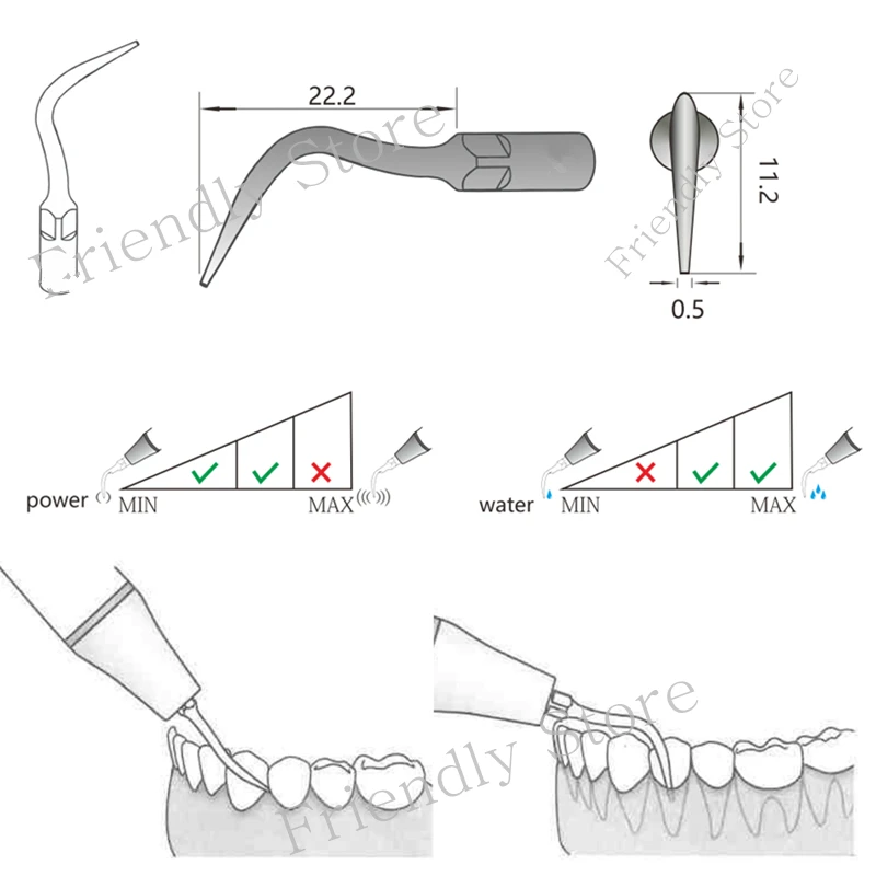 

5Pcs Teeth Cleaning Tools PD4 Dental Perio Tip For SATELEC And DTE Ultrasonic Scaler Use For Remove Subgingical Calculus Care