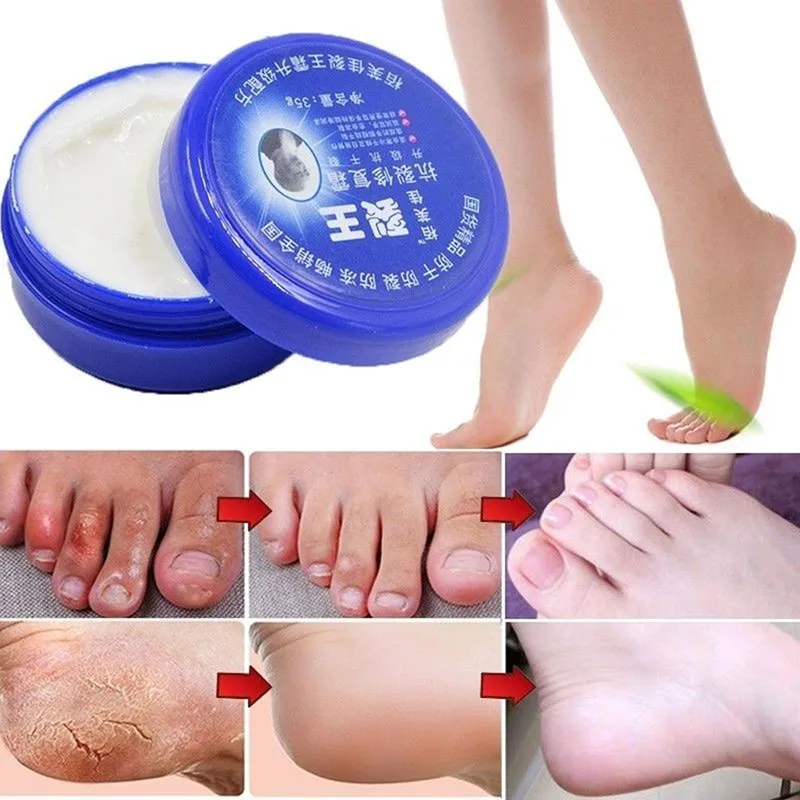 

New Traditional Chinese Balm Exfoliating Hand Foot Crack Cream Heel Chapped Peeling Feet Hand Repair Anti Dry Crack Skin Care