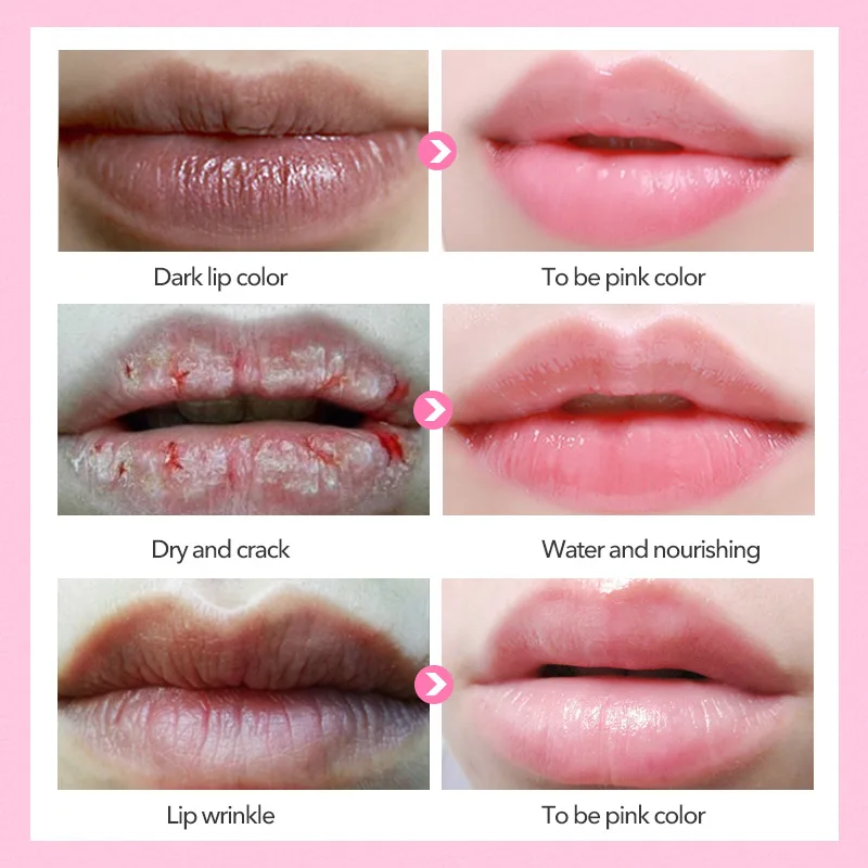 Маска для губ Daralis 5 шт. прозрачные патчи с коллагеном влага от старения против