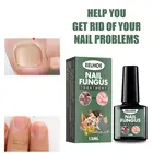 Средство для лечения грибков ногтей, жидкое питательное средство для удаления грибка ногтей, против паронихии и онихомикоза, для ремонта ногтей от грибков TSLM1