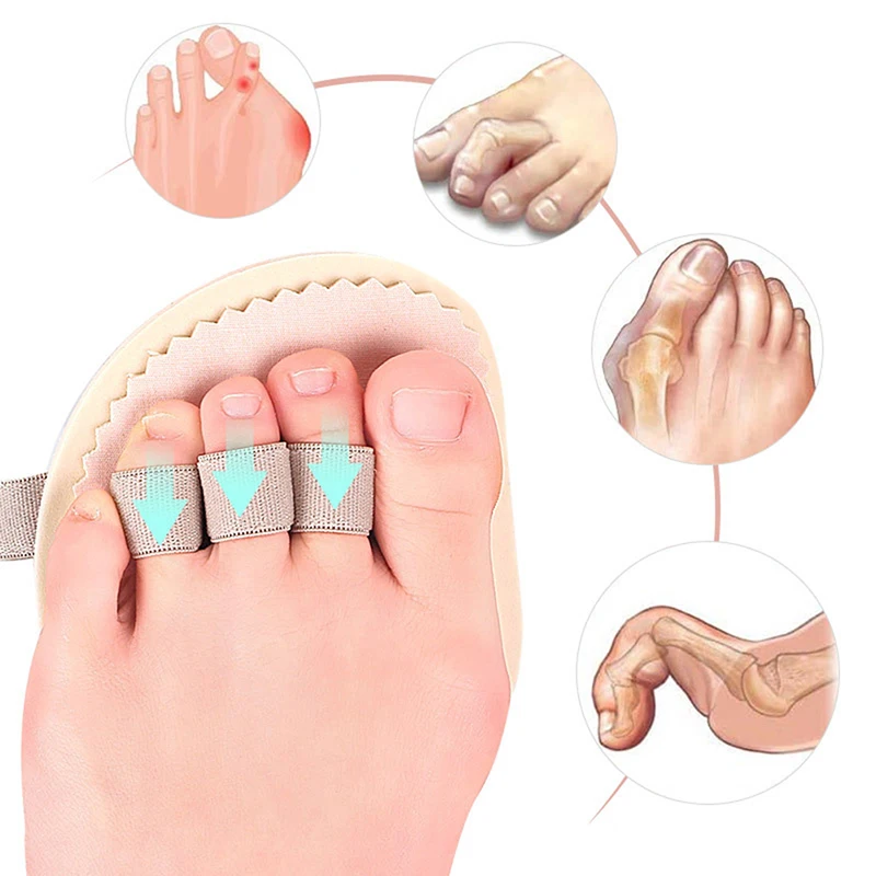 

Forefoot Pads Soft Bunion Corrector Toe Separator Straightener Thumb Valgus Protector Toes Spreader Corrector