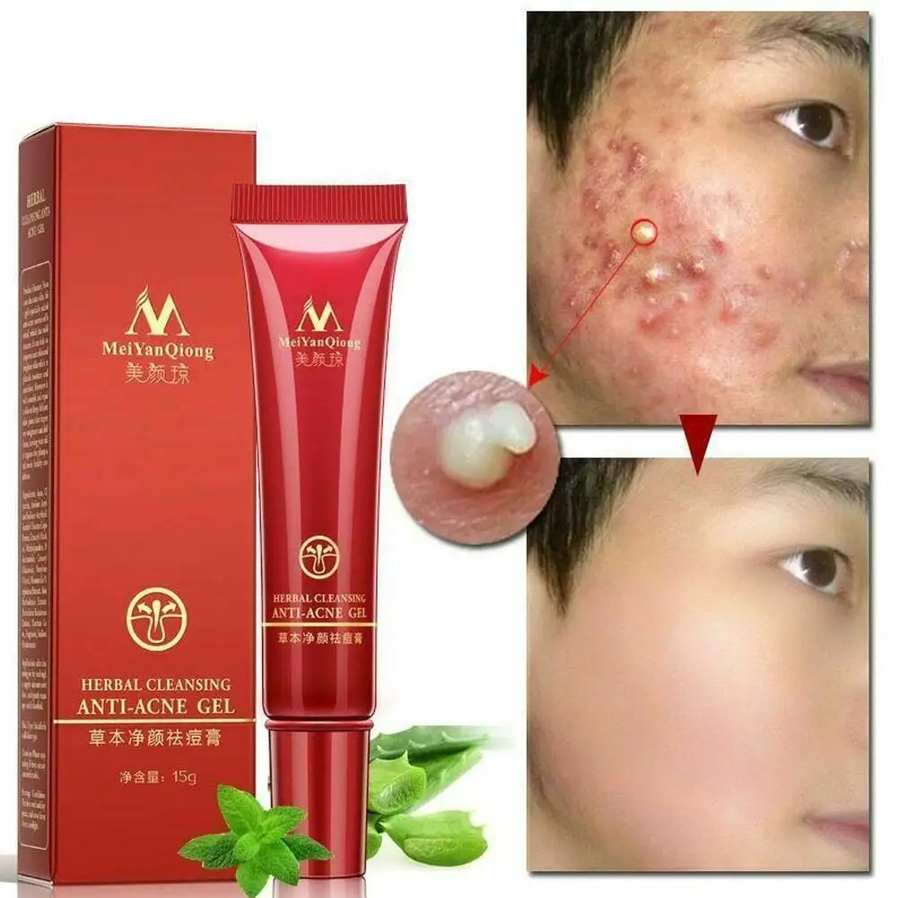15 мл уход за кожей лица акне очищающий крем по уходу для удаления ремонт