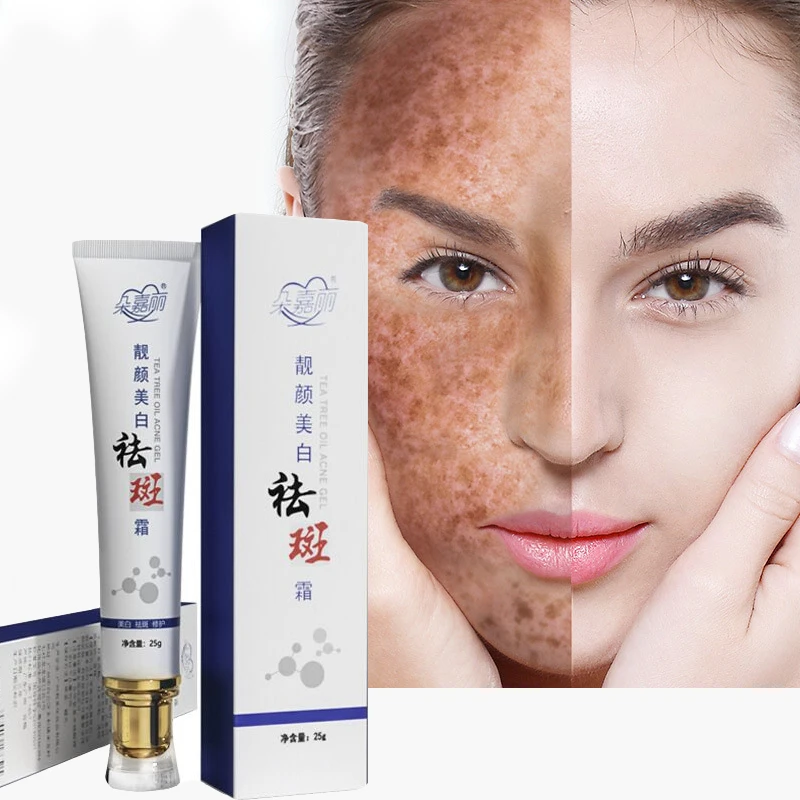 Effective Whitening Freckle Cream Remove Melasma Acne Spot Pigment Melanin Dark Spots Pigmentation Moisturizing Gel Skin Care | Красота и