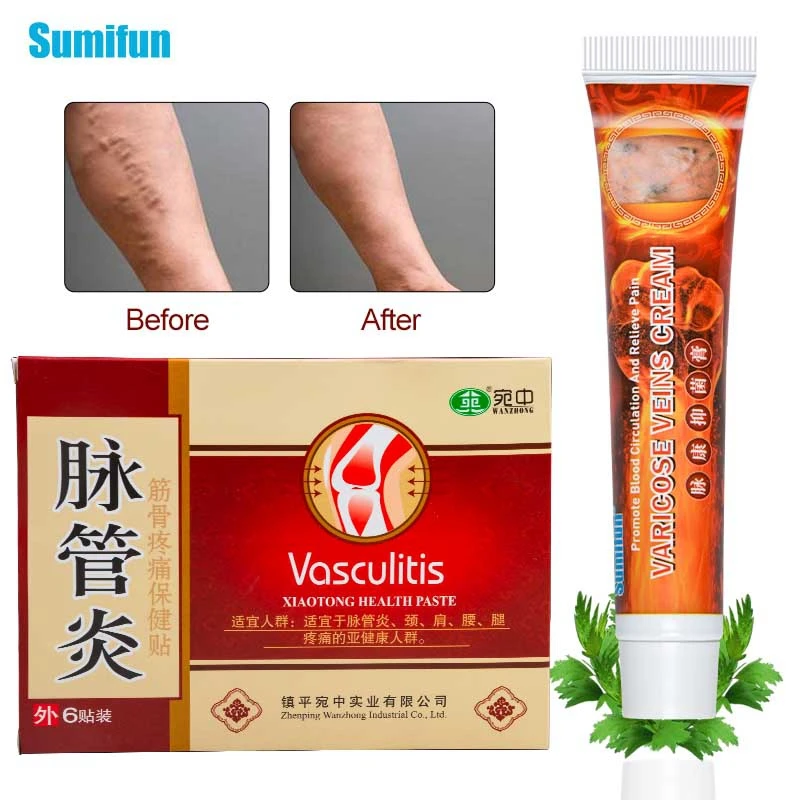 Лекарственные патчи для лечения варикозного расширения вен крем-мазь васкулита