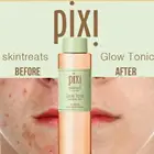 Pixi 5% гликолевая кислота Увлажняющий контроль жирности подтяжки кожи против акне эссенция косметический тонер подходит для сухой и жирной bioaqua тоналка для лица кислотный пилинг