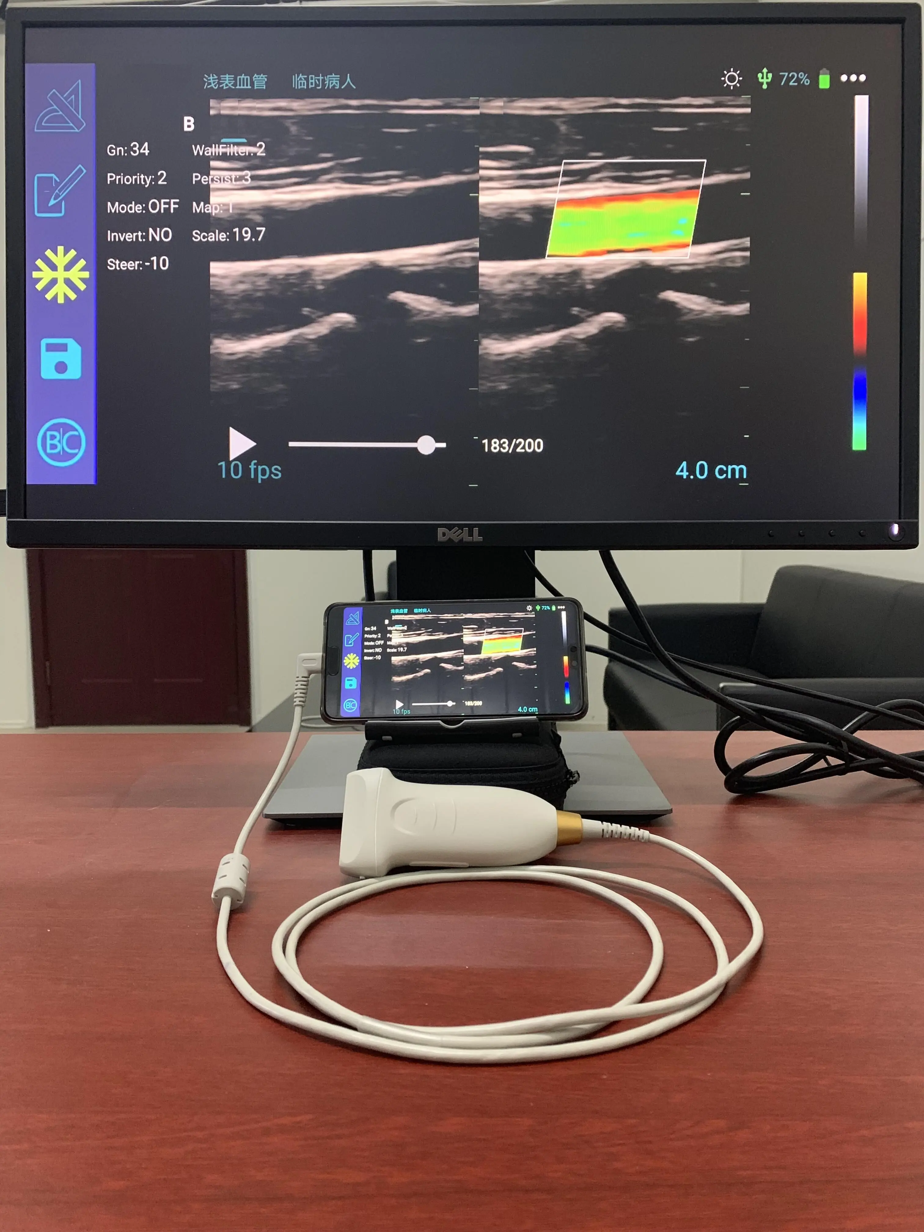 Лидер продаж ручной цветной допплер USB с линейным зондом 128 элементов - купить по