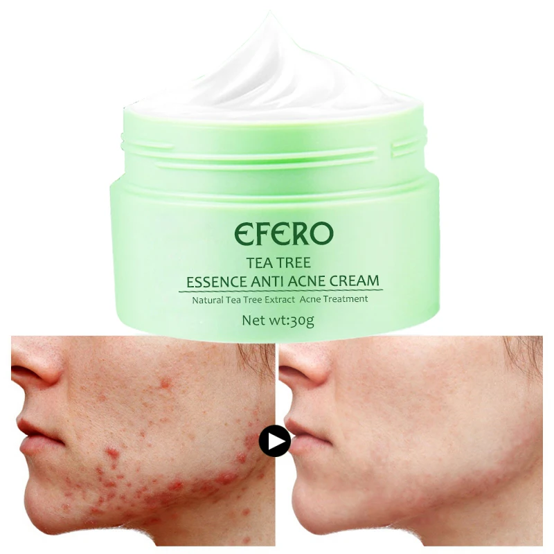 Крем для лица EFERO Tea Tree влажность смягчитель антивозрастное отбеливание удаление
